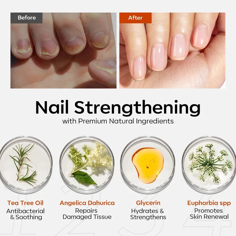 Modelones Nail Antifungal Treatment nagelolja