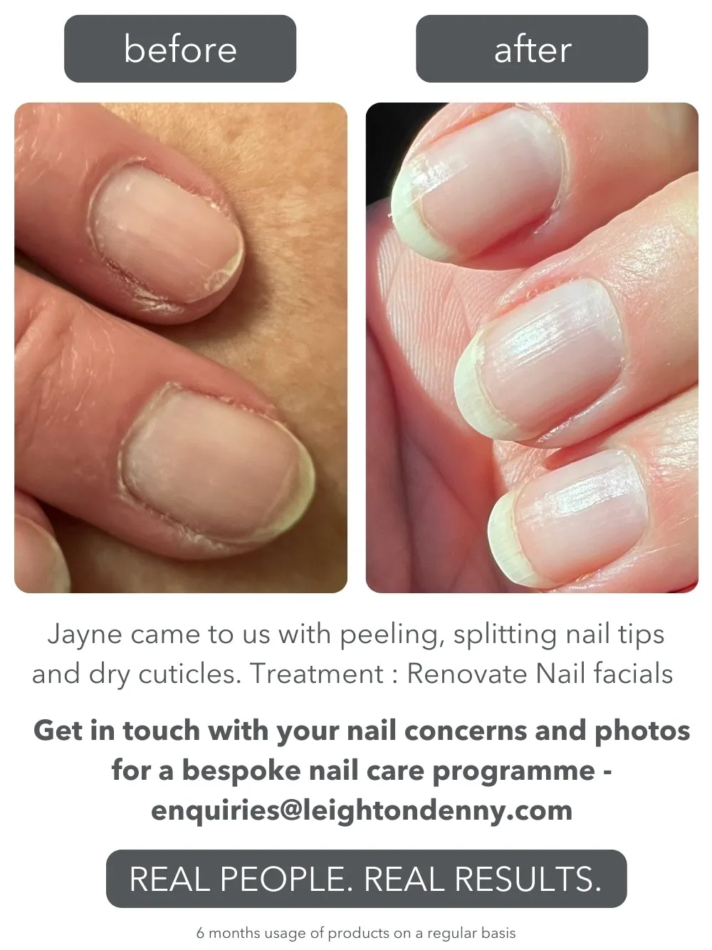 Leighton Denny Renovate Nail Facial nagelkit för torra naglar