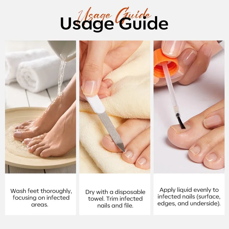 Modelones Nail Antifungal Treatment nagelolja